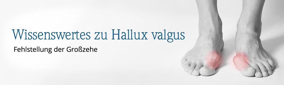 Wissenswertes zu Hallux valgus Wissenswertes zu Hallux valgus