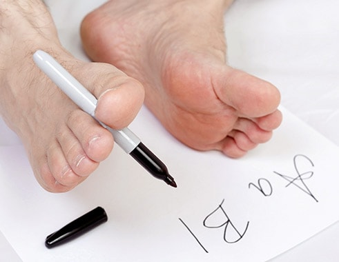 Zehengymnastik bei Hallux valgus Zehengymnastik bei Hallux valgus