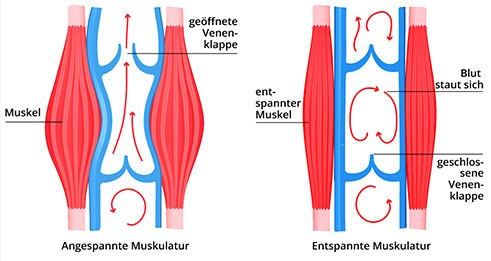 Muskelpumpe | Avena Muskelpumpe | Avena